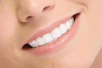 Do’s and Don’ts of Porcelain Veneers Sarasota