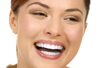 Smile Makeover Sarasota FAQs