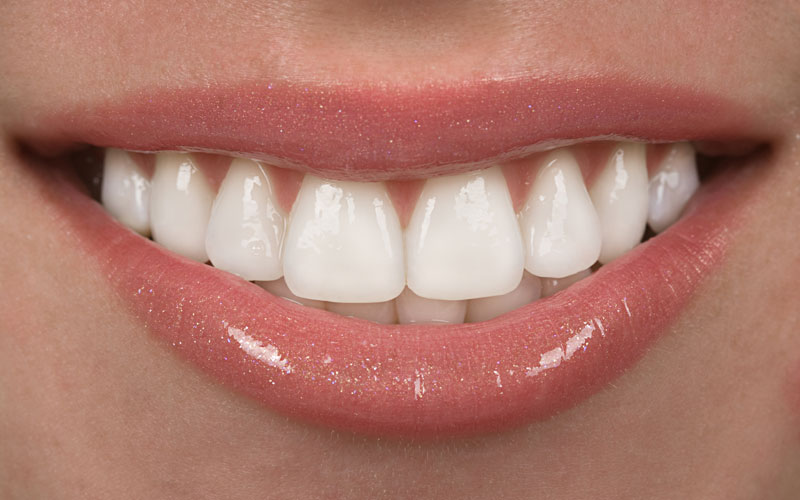 Whitening Your SMILE – The pros and cons of teeth whitening