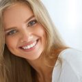 Teeth Whitening - Sarasota Smile Design